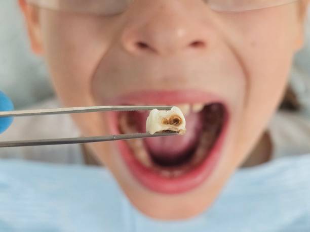 Best Weekend Emergency Dental Services in Hutchinson, MN